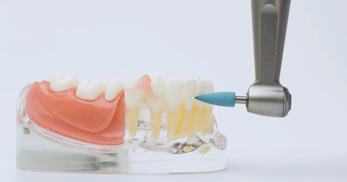 Profilaxia dental